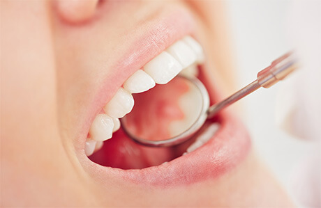 口腔内写真・歯周組織精密検査